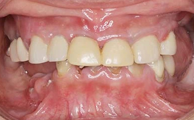 Before image