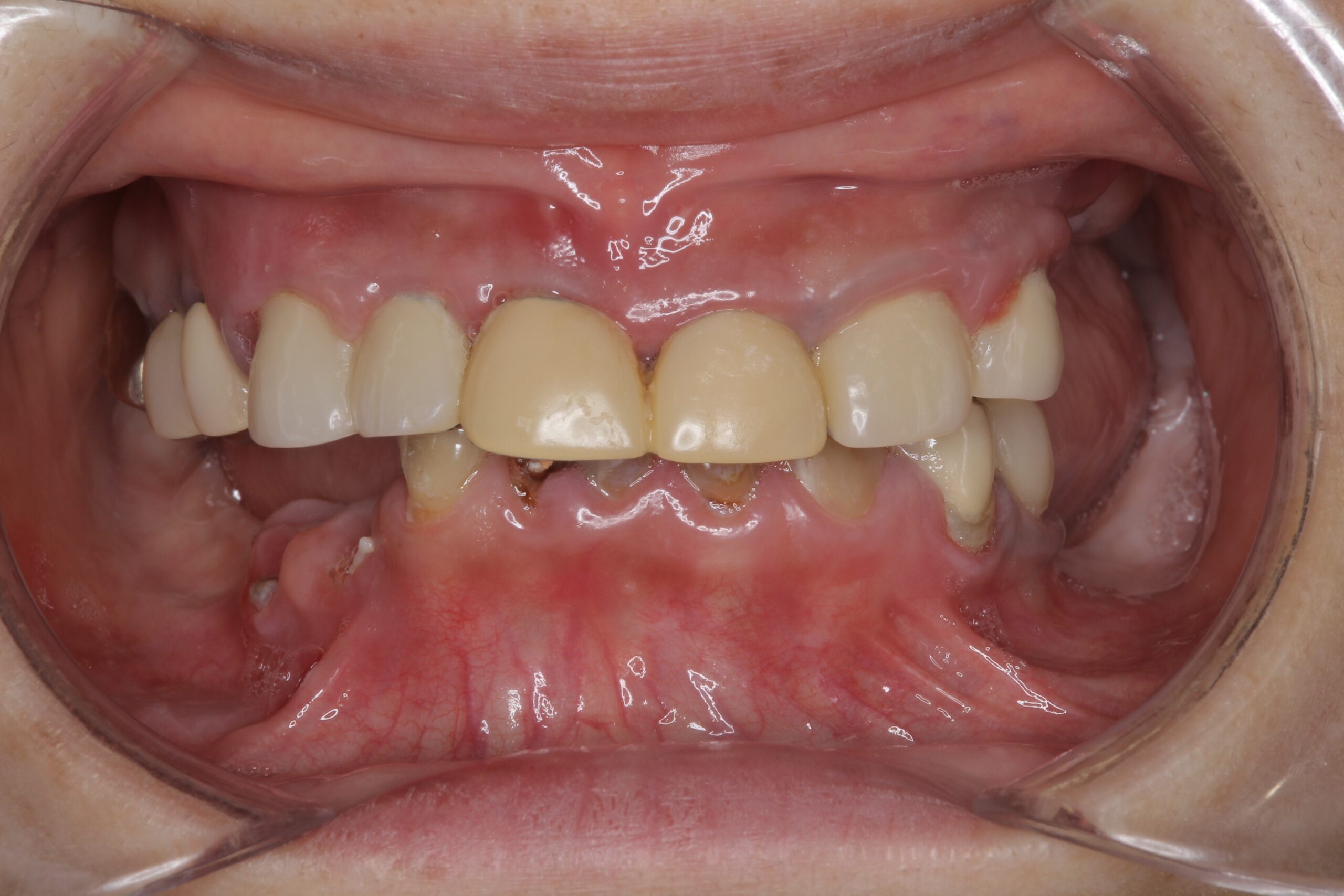 Before image