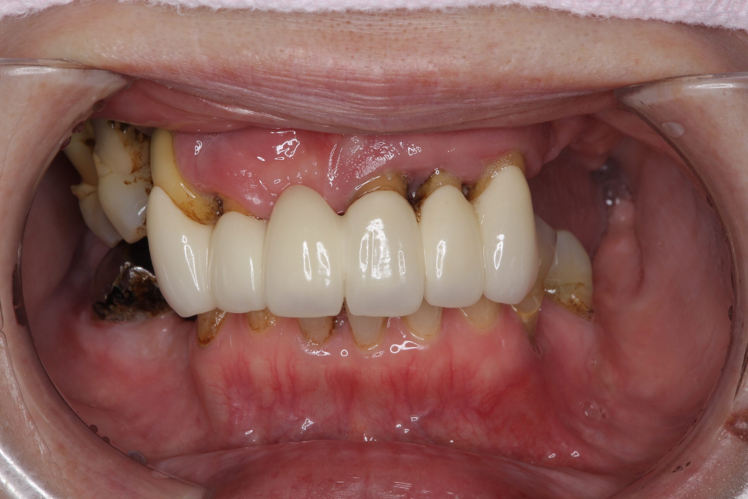 Before image