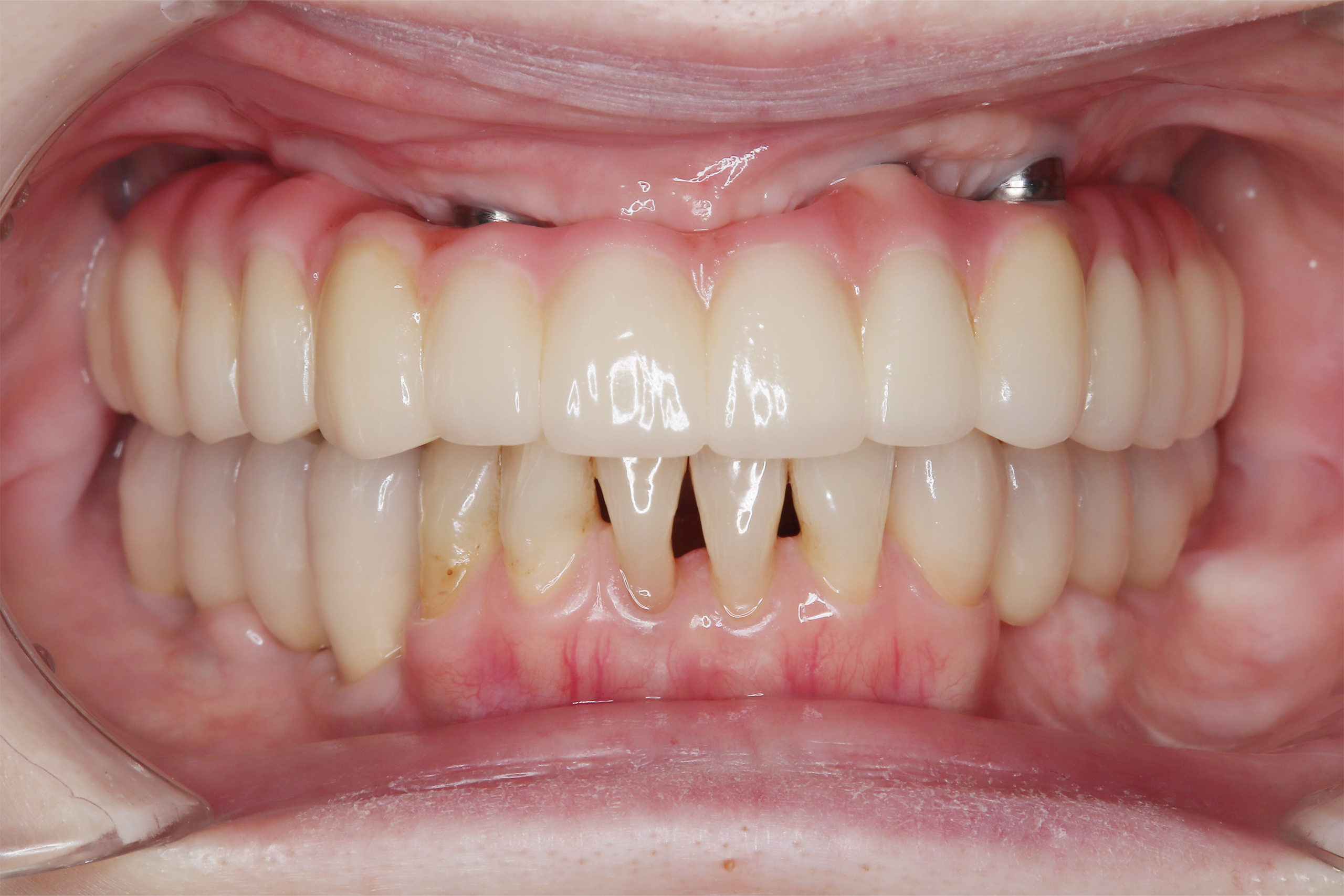 After image