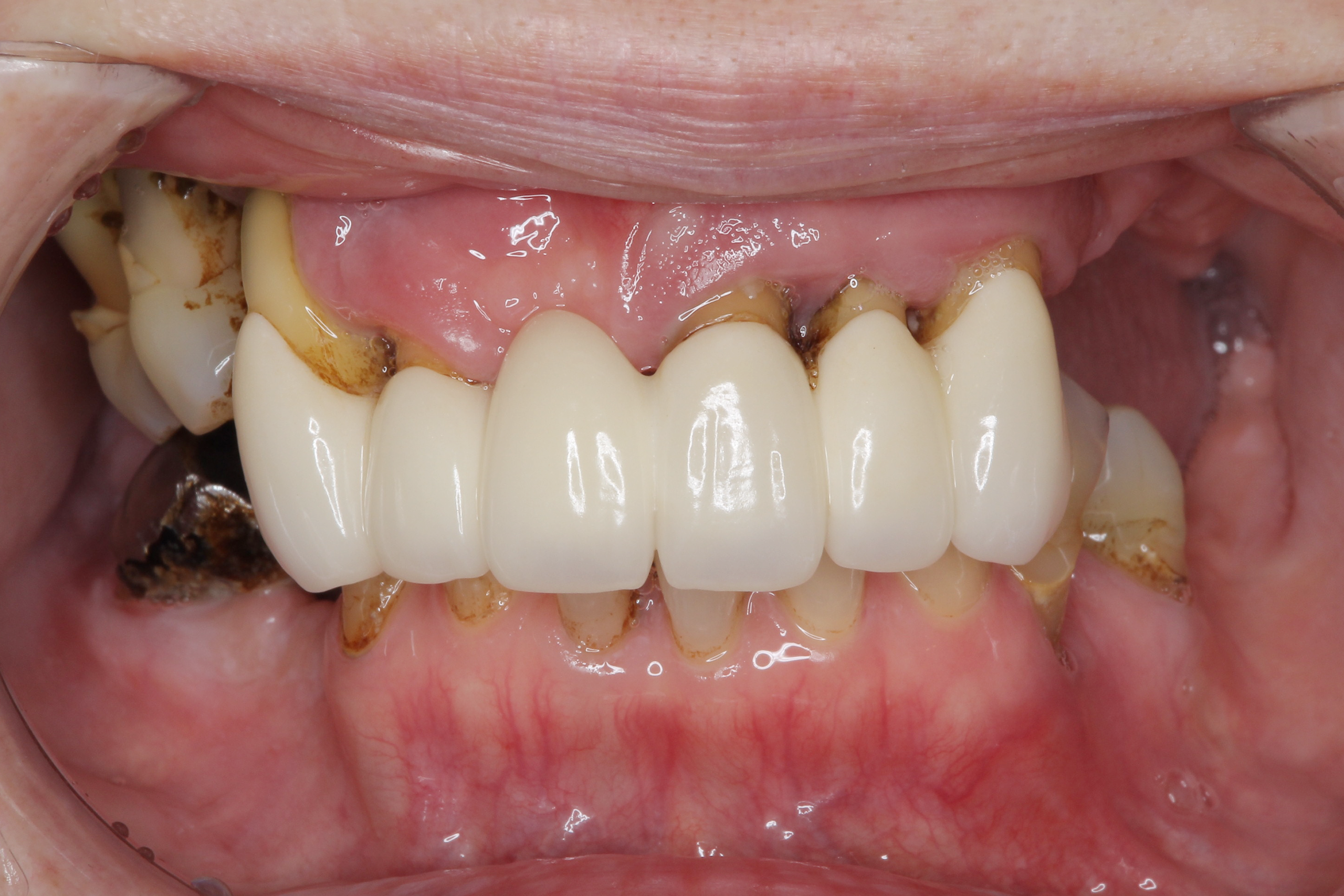 Before image