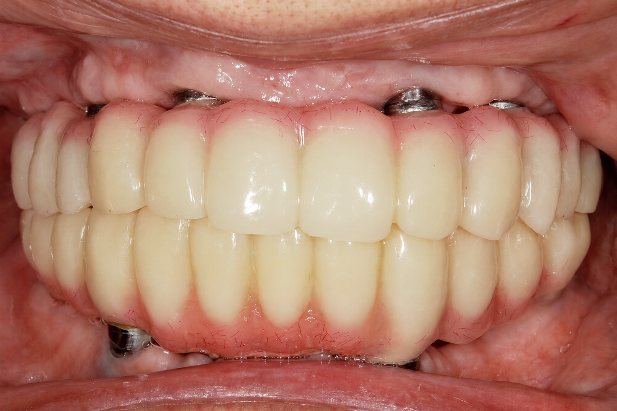 After image