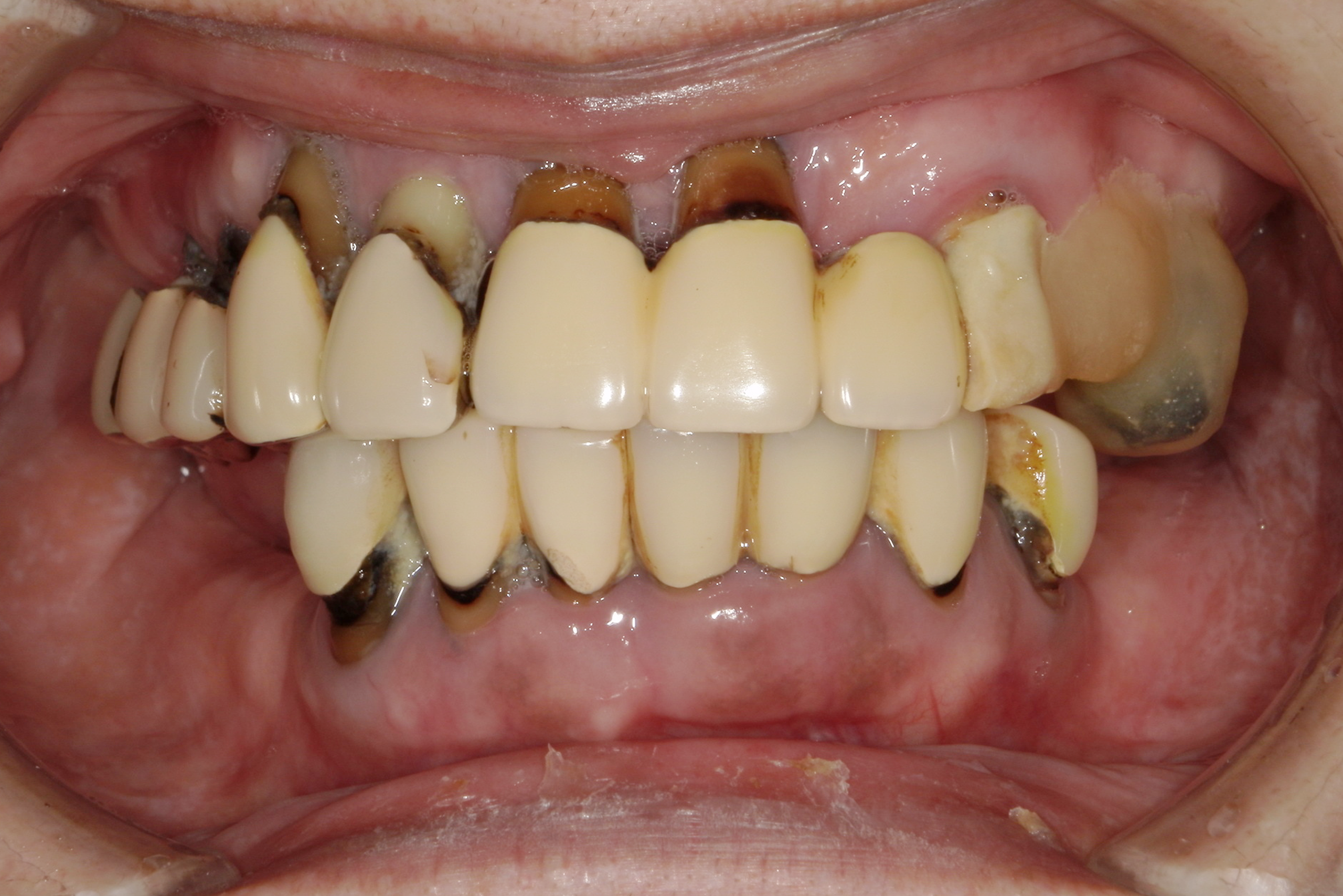 Before image
