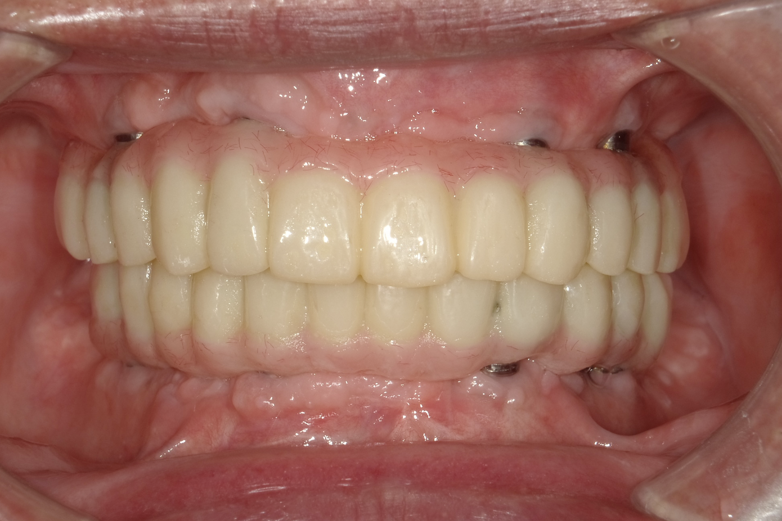 After image