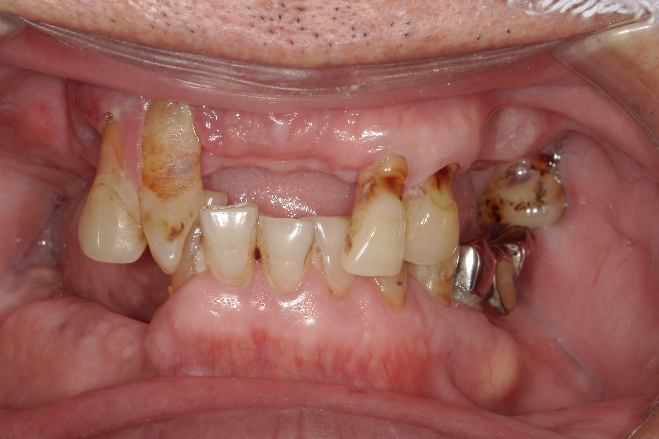 Before image