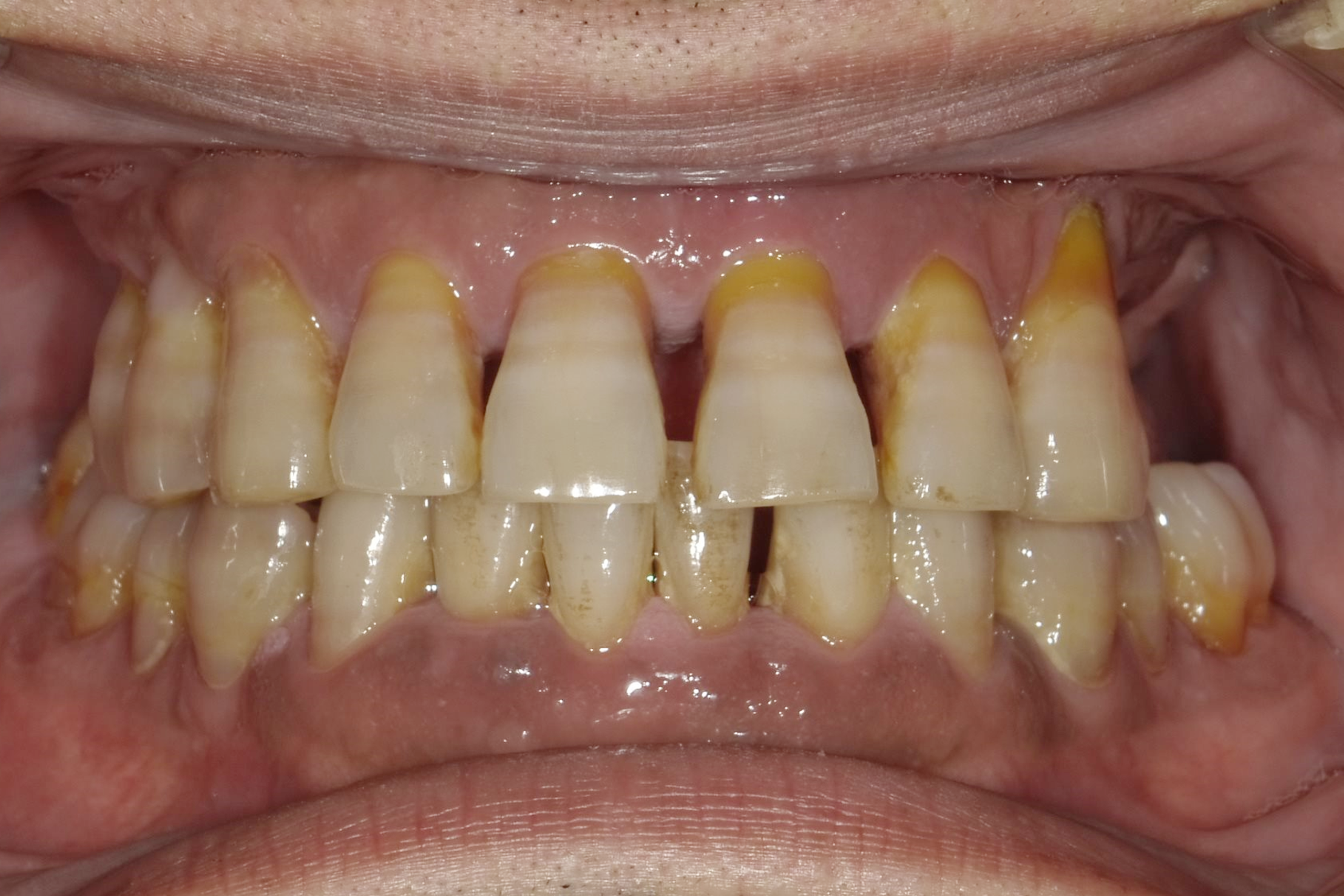 Before image