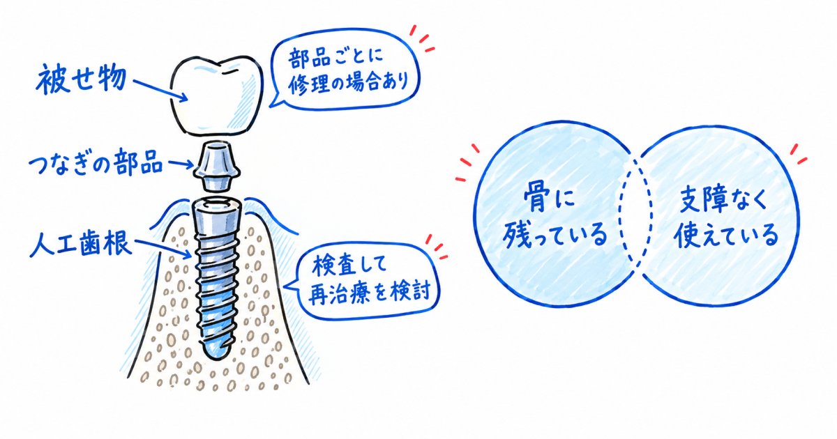 インプラントは何年もつ？「残っている」と「使えている」は別