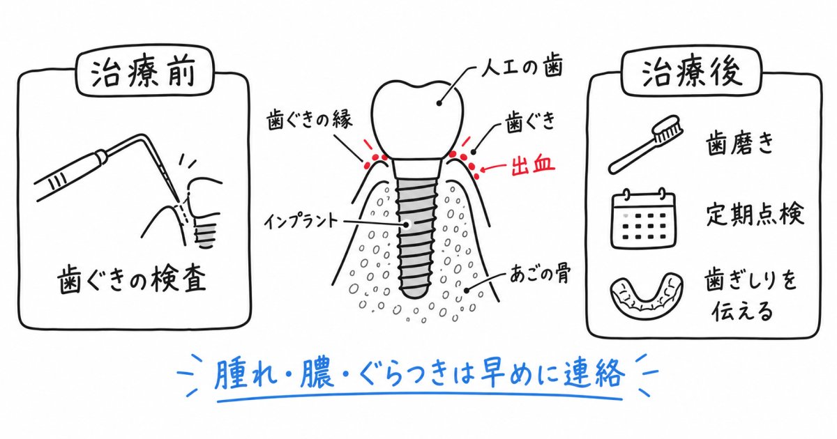 歯ぐきの出血が気になる方へ｜長期使用を左右する変化