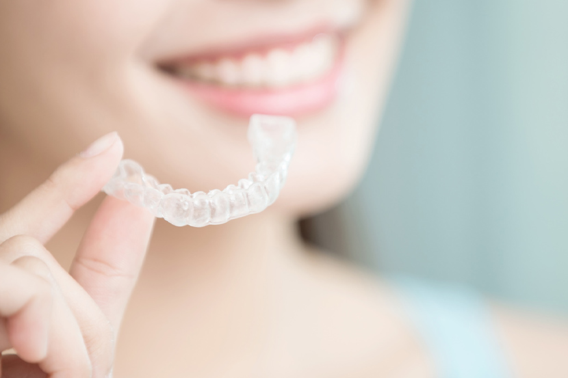 インビザライン