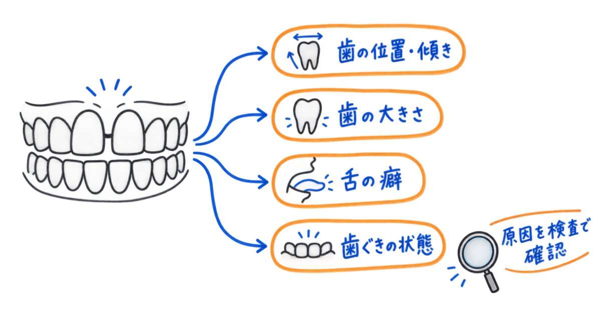 すきっ歯はマウスピースで治る？すき間の原因から考える