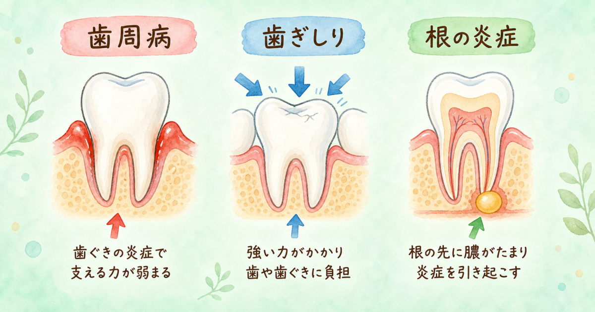 ■歯がグラグラして浮く原因を自分でチェックする3つの判断基準