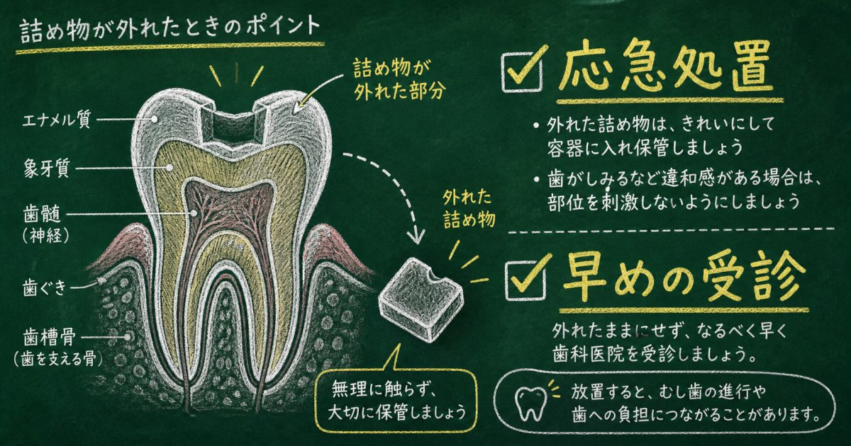 詰め物が取れたら放置は危険？応急処置と京橋での通院先選び