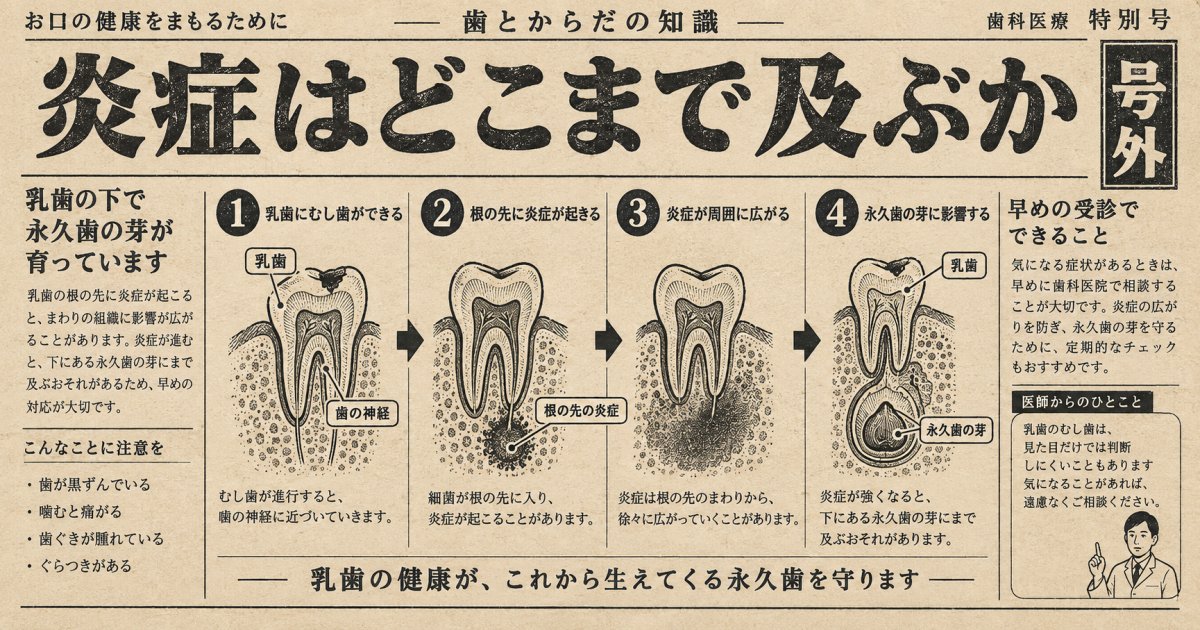 乳歯のむし歯放置が永久歯に及ぼす具体的な影響